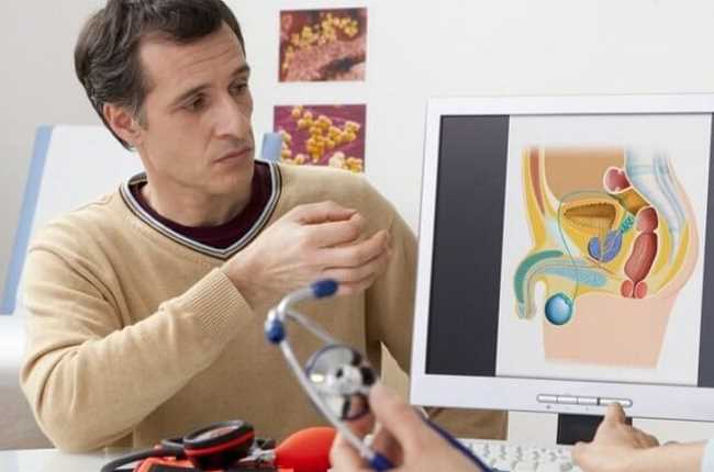 Кандидоз у мужчин