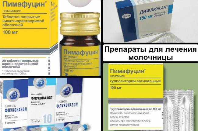Лечение молочницы у беременных женщин