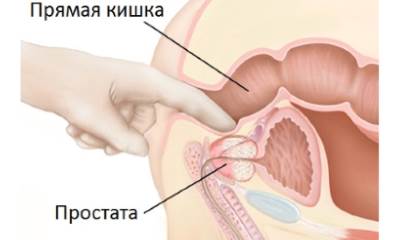 Массаж простаты пальцем