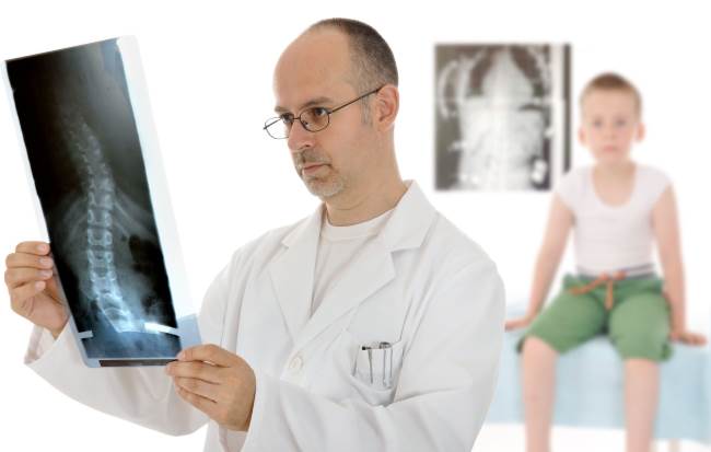 Сколиоз у детей