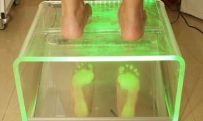 Поперечное плоскостопие