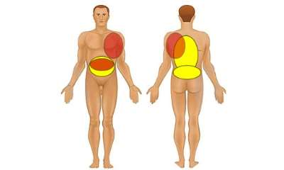 Где болит панкреатит