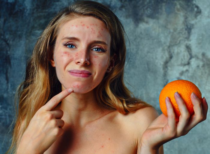 Симптомы аллергии на цитрусовые