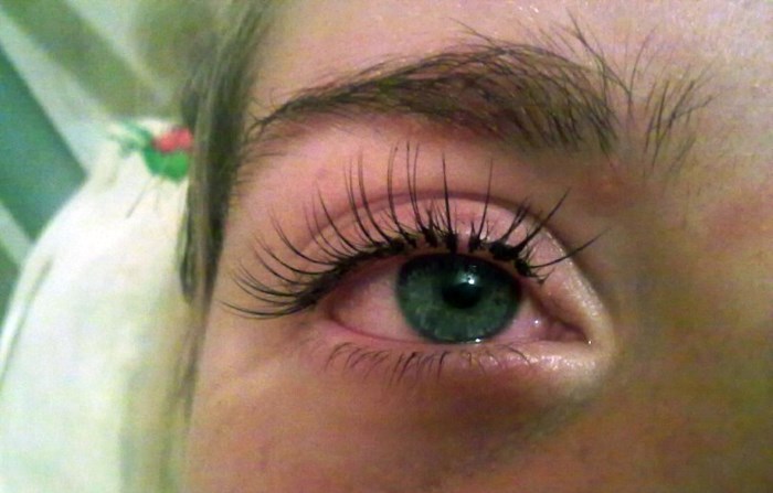 Аллергия на нарощенные ресницы