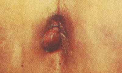 Как выглядит геморрой у детей