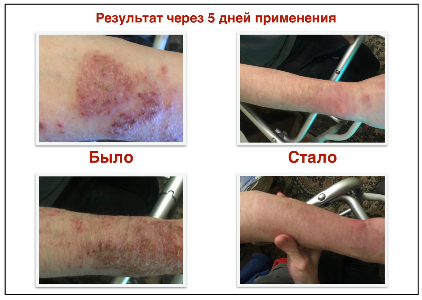 Здраводерм Восстановитель кожи