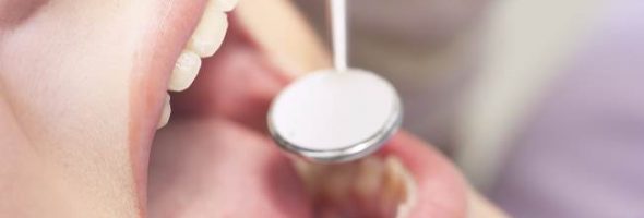 Кандидоз полости рта