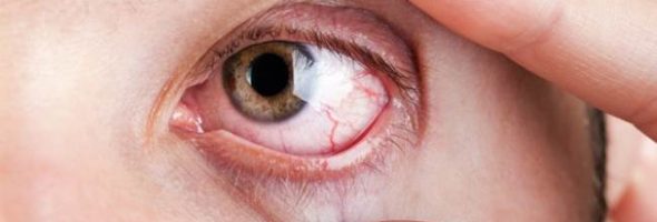 Как выглядит герпес на глазу