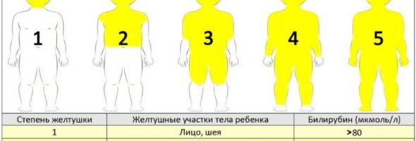Как выглядит желтуха