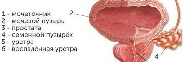 Как выглядит уретрит