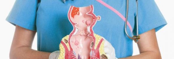 Как выглядит геморрой