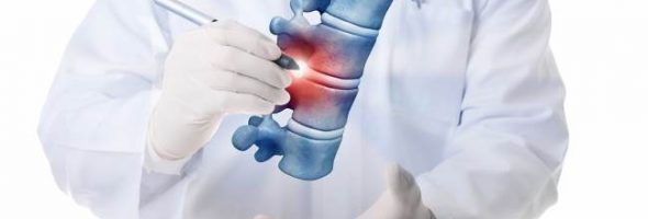 Как выглядит остеохондроз