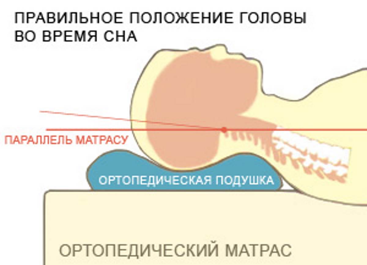 Как правильно спать при шейном остеохондрозе без ортопедической подушки фото пошагово в домашних